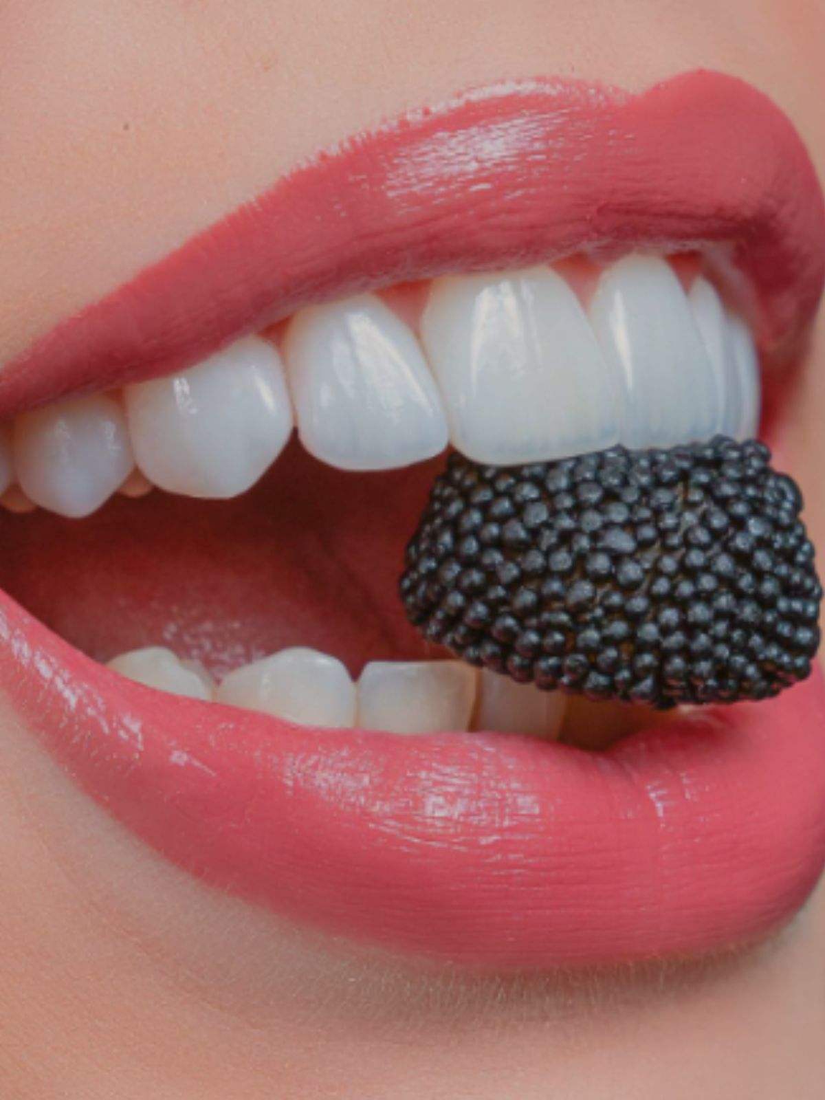 lentes_de_contato_dental_em_rondonopolis